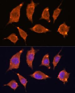 Anti-ATF5 Rabbit Polyclonal Antibody