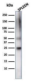 Western blot analysis of human spleen tissue lysate using Anti-TIM3 Antibody [TIM3/4024]