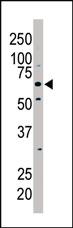 Anti-PKLR Rabbit Polyclonal Antibody