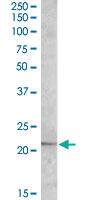 Anti-APOBEC3C Goat Polyclonal Antibody