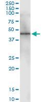 Anti-CANT1 Polyclonal Antibody Pair