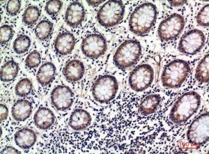 Immunohistochemical analysis of paraffin-embedded human uterus using Anti-OAS2 Antibody