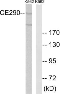 Antibody anti-CEP290 A98824-100 100 µg