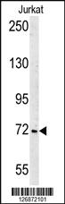 Anti-SHCBP1 Rabbit Polyclonal Antibody