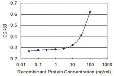 Anti-PDXK Mouse Monoclonal Antibody [clone: 4G6]