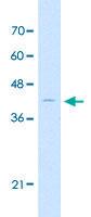 Anti-ARRB2 Rabbit Polyclonal Antibody