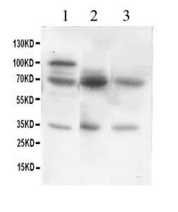 Anti-GAD67 Polyclonal Antibody