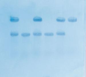 Kit Ready-to-Load™, recherche du gène responsable de la drépanocytose par la méthode de transfert de Southern