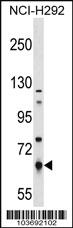 Anti-PKLR Rabbit Polyclonal Antibody