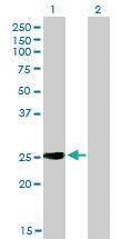 Anti-IGSF6 Mouse Monoclonal Antibody [clone: 2A12]