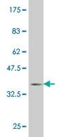 Anti-LEFTY1 Mouse Monoclonal Antibody [clone: 3B5]