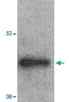 Anti-ARRB2 Rabbit Polyclonal Antibody