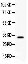 Anti-GST3/GST Pi Polyclonal Antibody