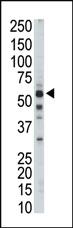 Anti-PKLR Rabbit Polyclonal Antibody