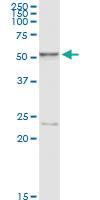 Anti-HEXA Mouse Monoclonal Antibody [clone: 3D1]