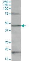 Anti-HTR1A Goat Polyclonal Antibody