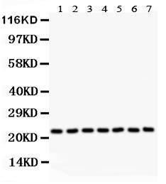 Anti-GST3/GST Pi Polyclonal Antibody