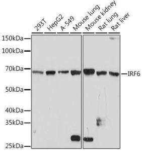 Western blot analysis of extracts of various cell lines, using Anti-IRF6 Antibody [ARC1928] (A308141) at 1:1,000 dilution