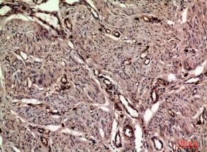 Immunohistochemical analysis of paraffin-embedded human uterus using Anti-OAS2 Antibody