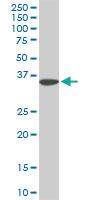 Anti-FHL1 Mouse Monoclonal Antibody [clone: 2A9]