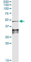 Anti-LEFTY1 Antibody Pair