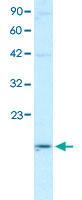 Anti-APOBEC3G Rabbit Polyclonal Antibody