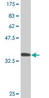 Anti-CDON Mouse Monoclonal Antibody [clone: 2G12]