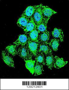 Anti-MSS51 Rabbit Polyclonal Antibody (AP (Alkaline Phosphatase))