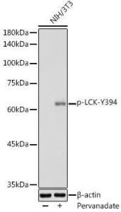 Western blot analysis of extracts of NIH/3T3 cells, using Anti-Lck (phospho Tyr394) Antibody (A12463) at 1:1,000 dilution