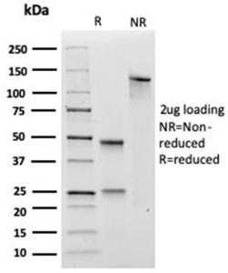 SDS-PAGE analysis of Anti-SOX4 Antibody [PCRP-SOX4-1D6] under non-reduced and reduced conditions; showing intact IgG and intact heavy and light chains, respectively SDS-PAGE analysis confirms the integrity and purity of the antibody