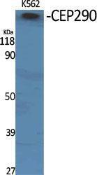 Antibody anti-CEP290 A98824-100 100 µg