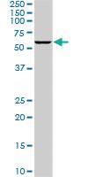 Anti-PLK1 Mouse Monoclonal Antibody [clone: 4G11]