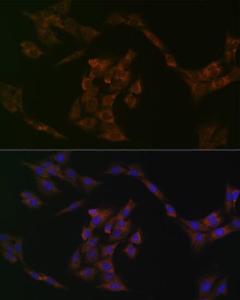 Immunofluorescence analysis of C6 cells using Anti-IRF6 Antibody [ARC1928] (A308141) at a dilution of 1:100 (40X lens). DAPI was used to stain the cell nuclei (blue)