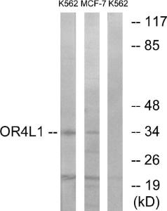 Western blot analysis of lysates from K562 and MCF-7 cells using Anti-OR4L1 Antibody. The right hand lane represents a negative control, where the Antibody is blocked by the immunising peptide