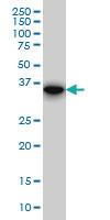 Anti-FHL1 Mouse Monoclonal Antibody [clone: 2A9]