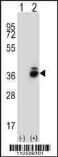 Anti-CRHBP Rabbit Polyclonal Antibody