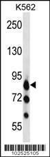 Anti-MARK3 Rabbit Polyclonal Antibody (Biotin)