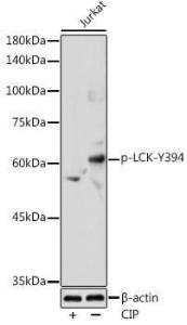 Western blot analysis of extracts of Jurkat cells, using Anti-Lck (phospho Tyr394) Antibody (A12463) at 1:1,000 dilution