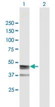 Anti-ASPN Mouse Polyclonal Antibody