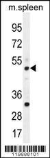 Anti-TBC1D13 Rabbit Polyclonal Antibody (AP (Alkaline Phosphatase))