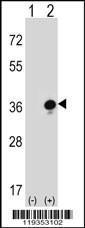 Anti-GZMB Rabbit Polyclonal Antibody