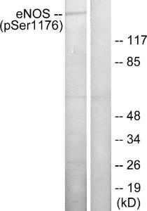 Western blot analysis of lysates from HeLa cells treated with Insulin 0.01 U/ml 15' using Anti-eNOS (phospho Ser1176) Antibody. The right hand lane represents a negative control, where the Antibody is blocked by the immunising peptide