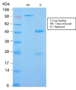 Anti-Desmin Rabbit Recombinant Antibody [clone: DES/2960R]