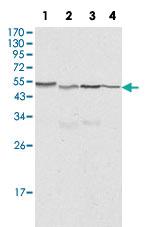 Anti-CALR Mouse Monoclonal Antibody [clone: 1G6A7]