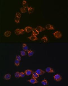 Immunofluorescence analysis of HeLa cells using Anti-IRF6 Antibody [ARC1928] (A308141) at a dilution of 1:100 (40X lens). DAPI was used to stain the cell nuclei (blue)