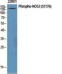 Western blot analysis of various cells using Anti-eNOS (phospho Ser1176) Antibody