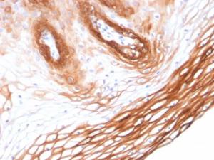 Immunohistochemical analysis of formalin-fixed, paraffin-embedded human skin using Anti-Cytokeratin 14 Antibody [KRT14/2375]