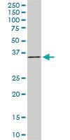 Anti-FHL1 Mouse Monoclonal Antibody [clone: 2A9]