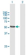 Anti-RRP1 Mouse Polyclonal Antibody