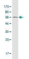 Anti-ALB Mouse Monoclonal Antibody [clone: 1E8]